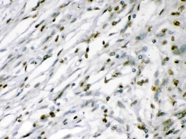 MEF2A Antibody in Immunohistochemistry (Paraffin) (IHC (P))