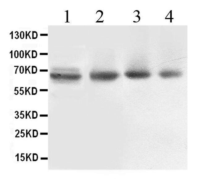 ABCB10 Antibody in Western Blot (WB)