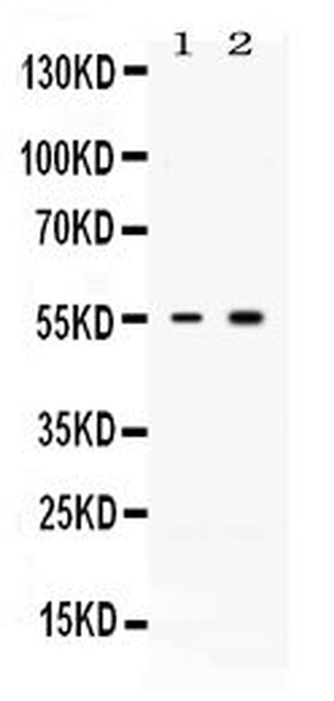 ACVR2B Antibody in Western Blot (WB)