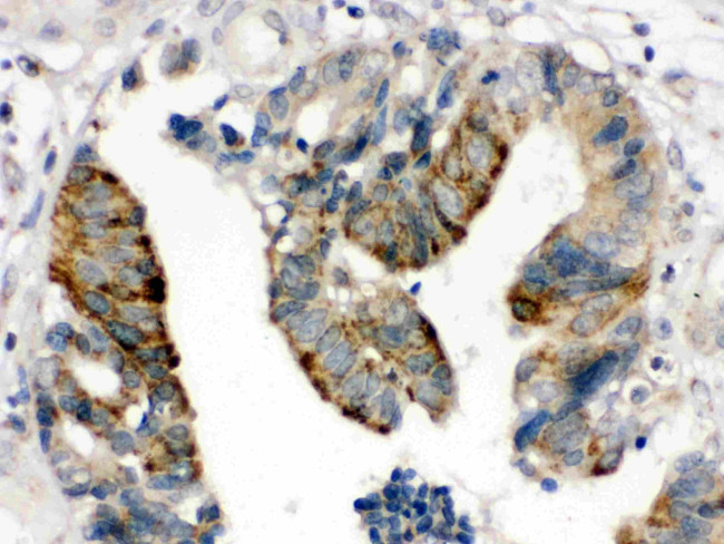 HMGB2 Antibody in Immunohistochemistry (Paraffin) (IHC (P))