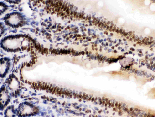 HMGB2 Antibody in Immunohistochemistry (Paraffin) (IHC (P))