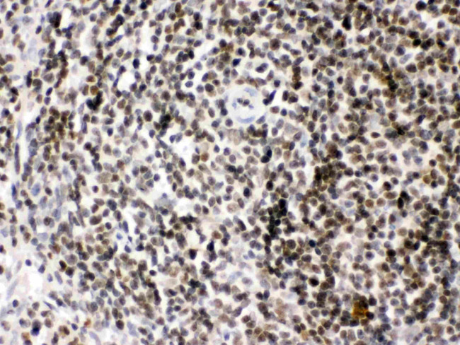 HMGB2 Antibody in Immunohistochemistry (Paraffin) (IHC (P))