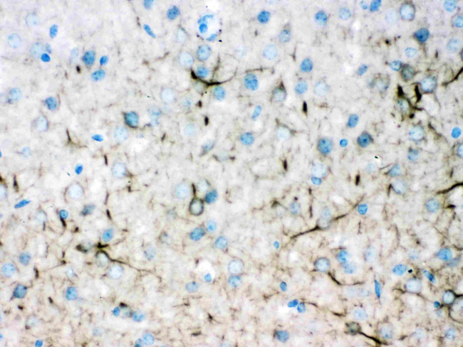 alpha Internexin Antibody in Immunohistochemistry (Paraffin) (IHC (P))