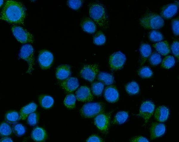 TAK1 Antibody in Immunocytochemistry (ICC/IF)