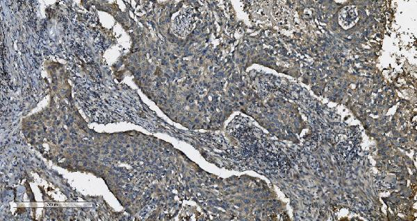 TPL2 Antibody in Immunohistochemistry (Paraffin) (IHC (P))