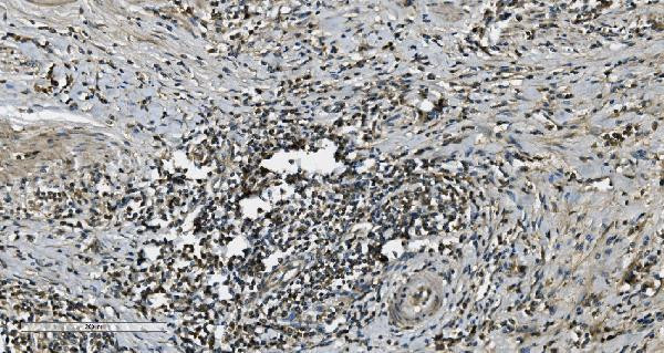 TPL2 Antibody in Immunohistochemistry (Paraffin) (IHC (P))