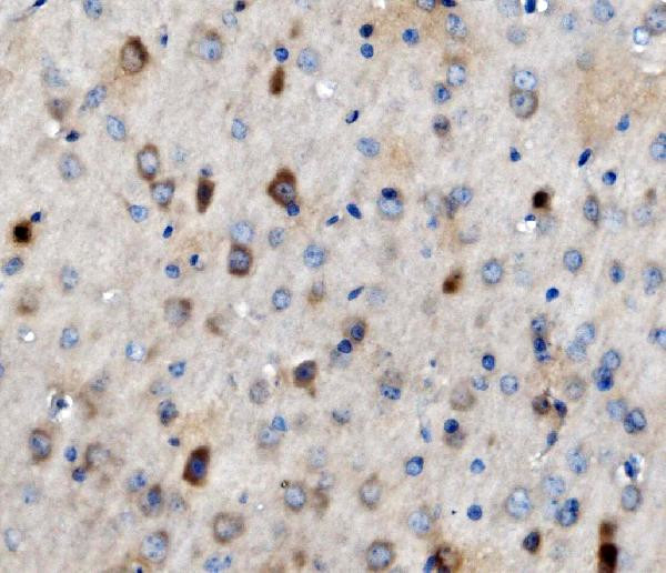 TPL2 Antibody in Immunohistochemistry (Paraffin) (IHC (P))