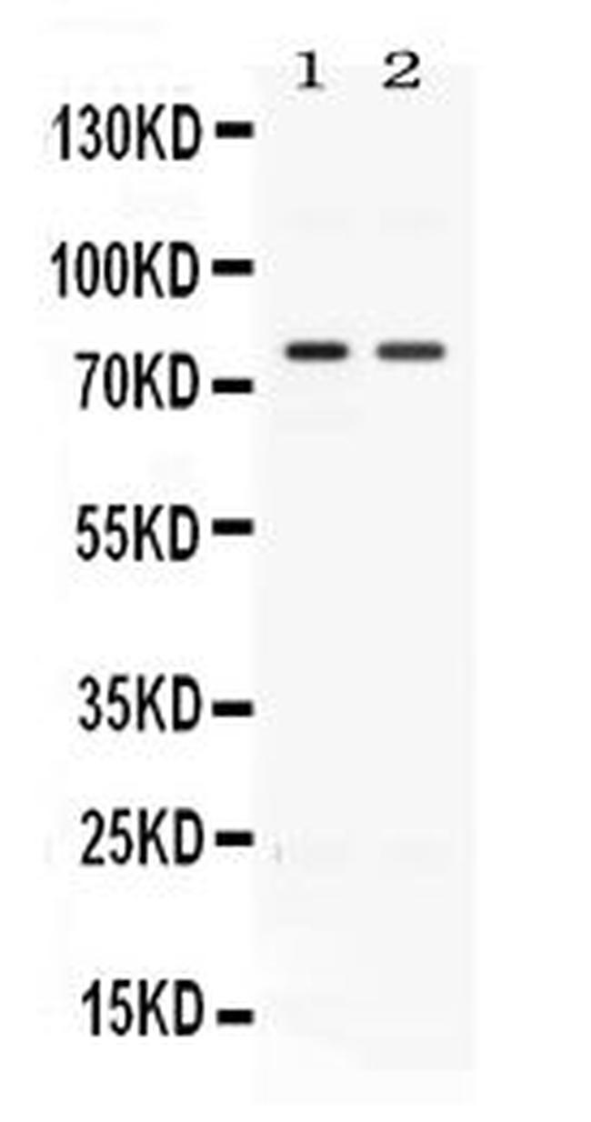 ACVR2A Antibody in Western Blot (WB)