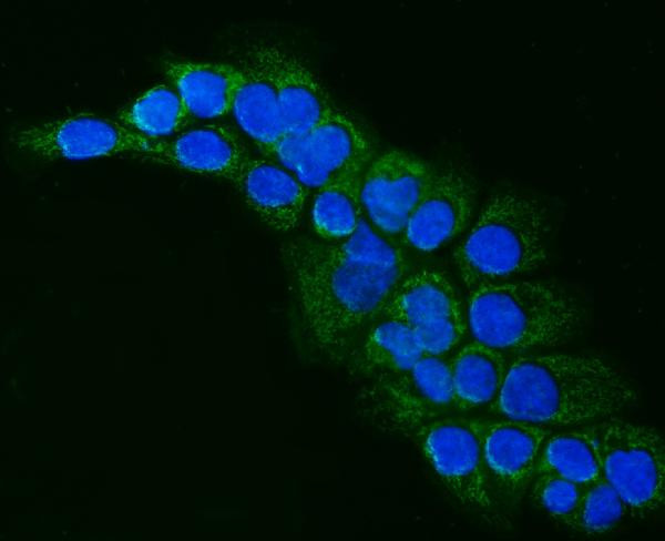 ALDH1B1 Antibody in Immunocytochemistry (ICC/IF)