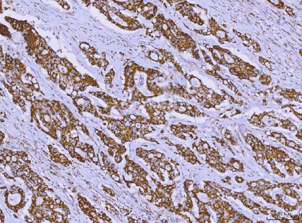 ALDH1B1 Antibody in Immunohistochemistry (Paraffin) (IHC (P))