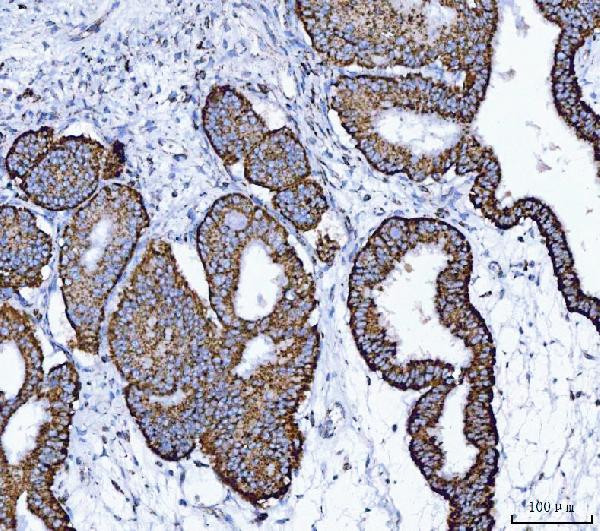 ALDH1B1 Antibody in Immunohistochemistry (Paraffin) (IHC (P))