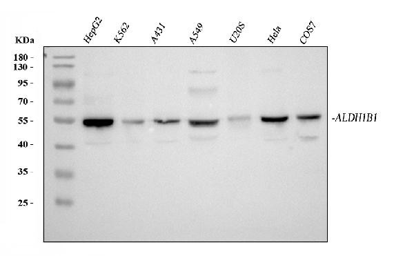 ALDH1B1 Antibody in Western Blot (WB)