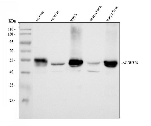 ALDH1B1 Antibody in Western Blot (WB)