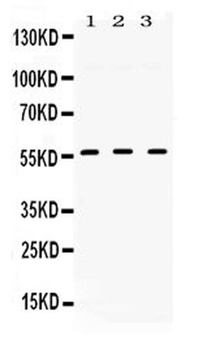 TGFBR1 Antibody in Western Blot (WB)