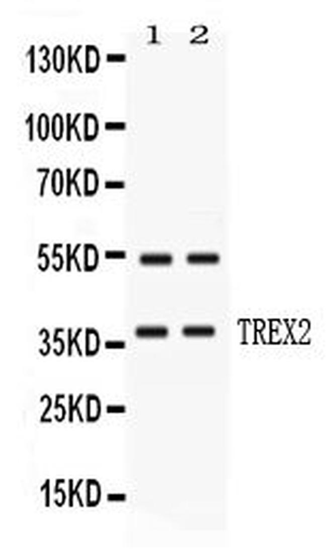 TREX2 Antibody in Western Blot (WB)