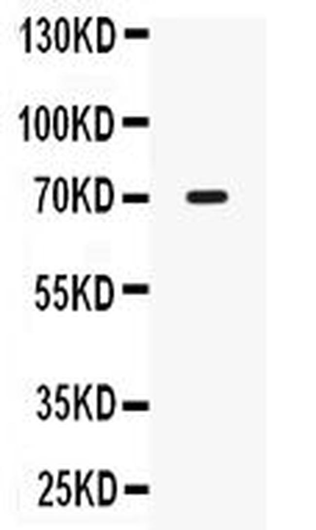 IL12RB1 Antibody in Western Blot (WB)