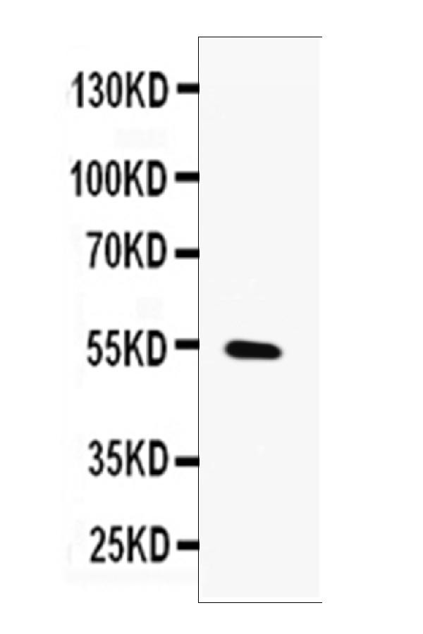 MMP13 Antibody in Western Blot (WB)