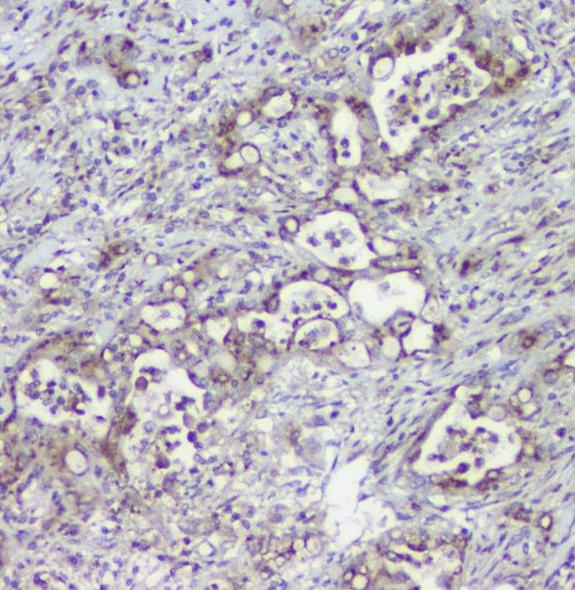 MPI Antibody in Immunohistochemistry (Paraffin) (IHC (P))