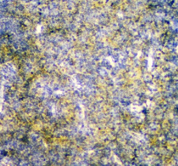 MPI Antibody in Immunohistochemistry (Paraffin) (IHC (P))