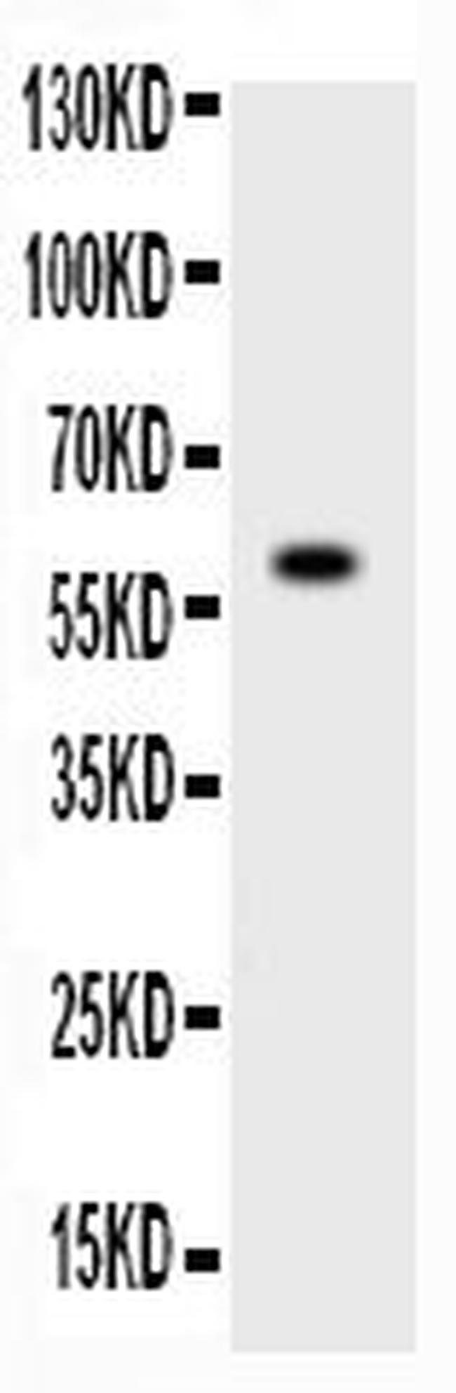 ADAMTS4 Antibody in Western Blot (WB)