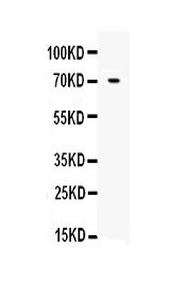 Angiopoietin 1 Antibody in Western Blot (WB)