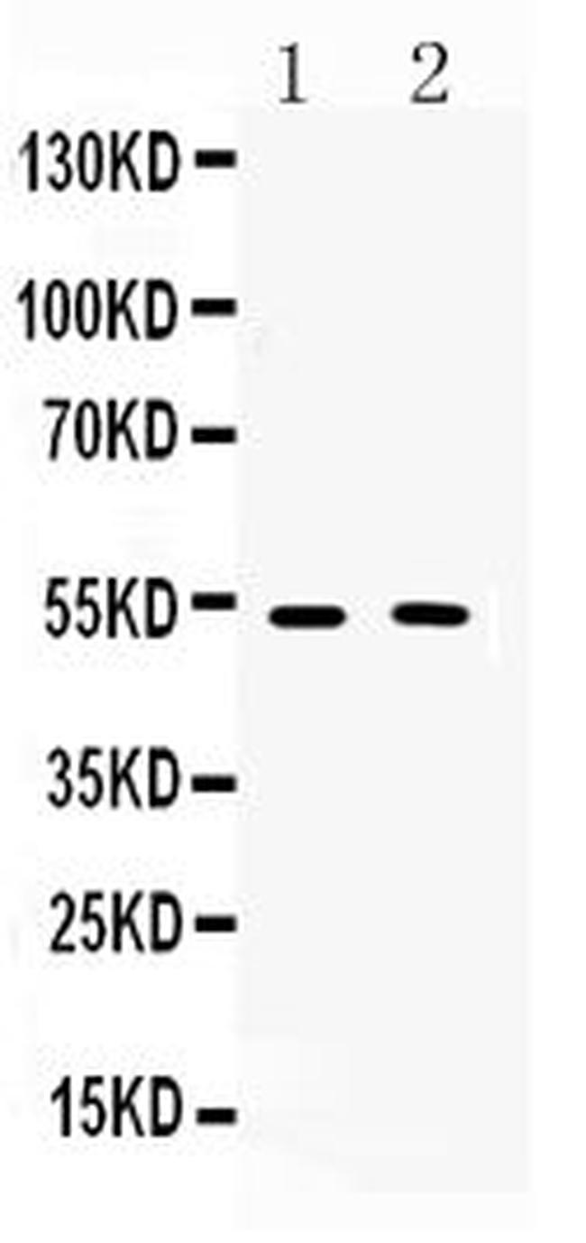 CHRM2 Antibody in Western Blot (WB)