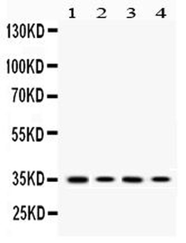 MC1R Antibody in Western Blot (WB)