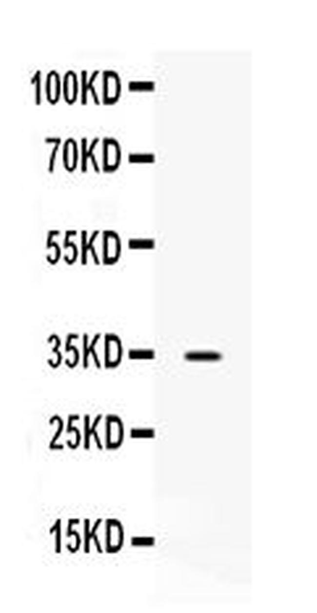 NAT1 Antibody in Western Blot (WB)