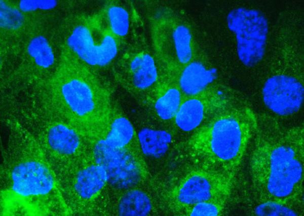 beta-2 Microglobulin Antibody in Immunocytochemistry (ICC/IF)