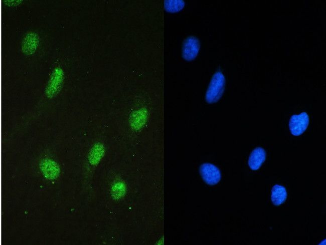 STAT1 Antibody in Immunocytochemistry (ICC/IF)