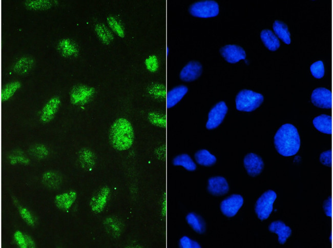 STAT1 Antibody in Immunocytochemistry (ICC/IF)