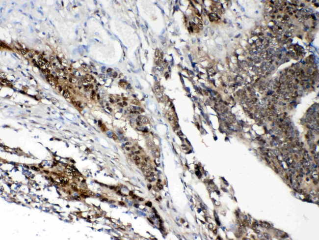 STAT1 Antibody in Immunohistochemistry (Paraffin) (IHC (P))