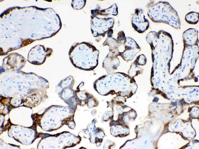 TFPI2 Antibody in Immunohistochemistry (Paraffin) (IHC (P))