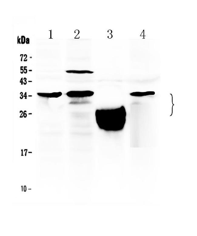 TFPI2 Antibody in Western Blot (WB)