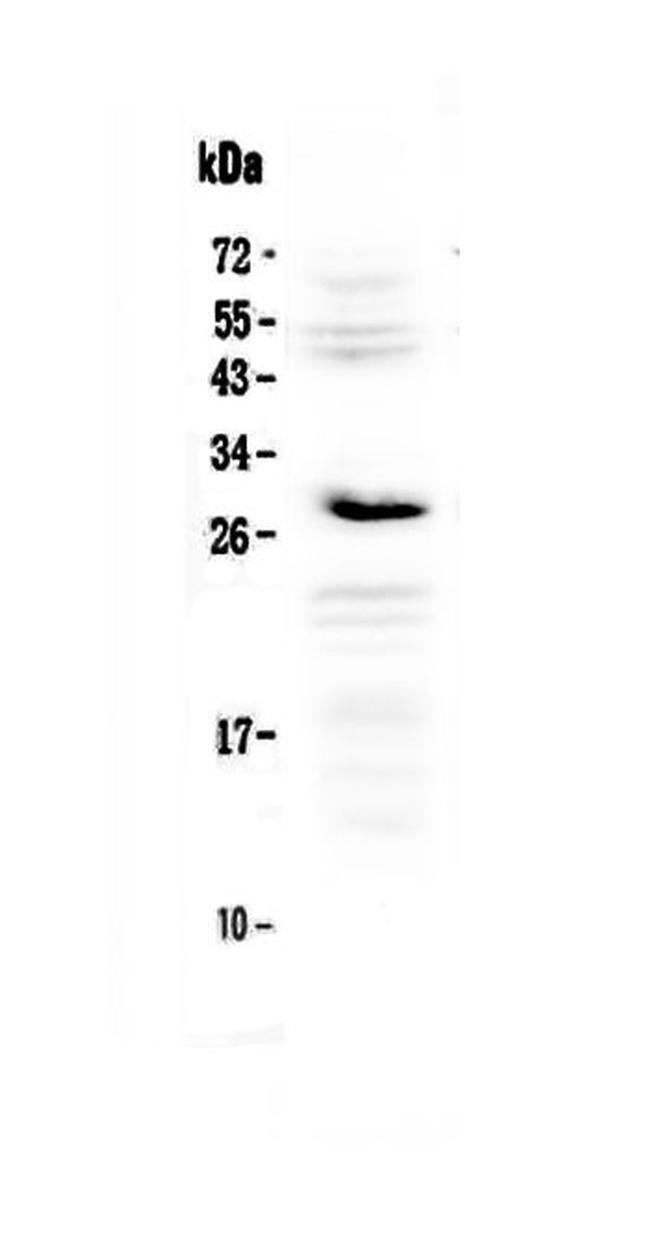 IL1RA Antibody in Western Blot (WB)