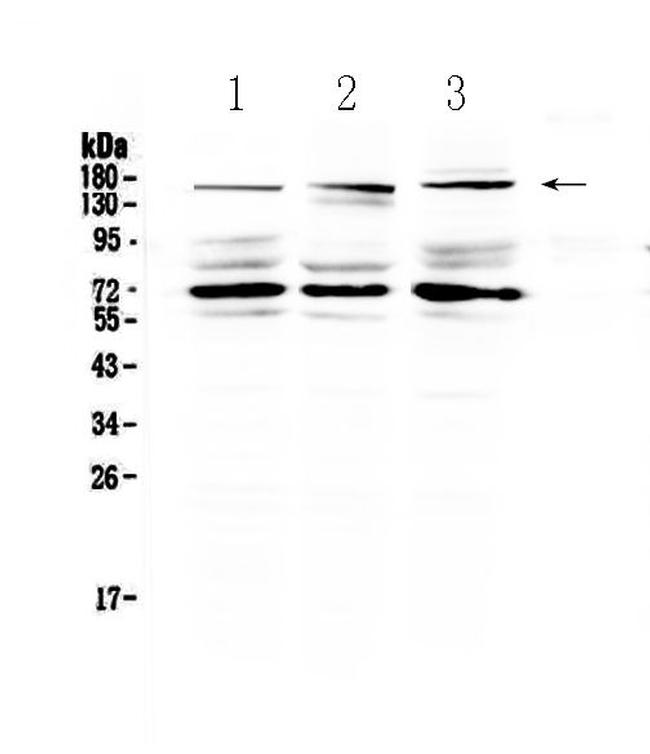 IL17RA Antibody in Western Blot (WB)