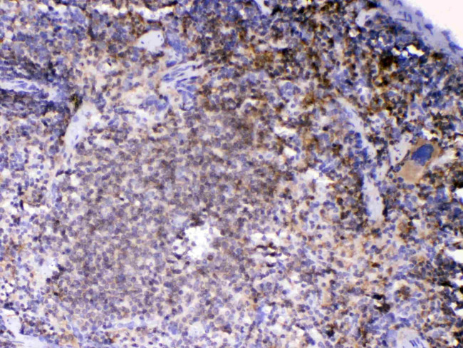 Lyn Antibody in Immunohistochemistry (Paraffin) (IHC (P))