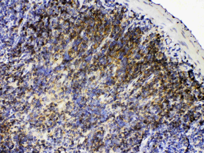 Lyn Antibody in Immunohistochemistry (Paraffin) (IHC (P))