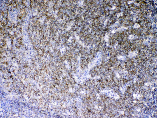 Lyn Antibody in Immunohistochemistry (Paraffin) (IHC (P))