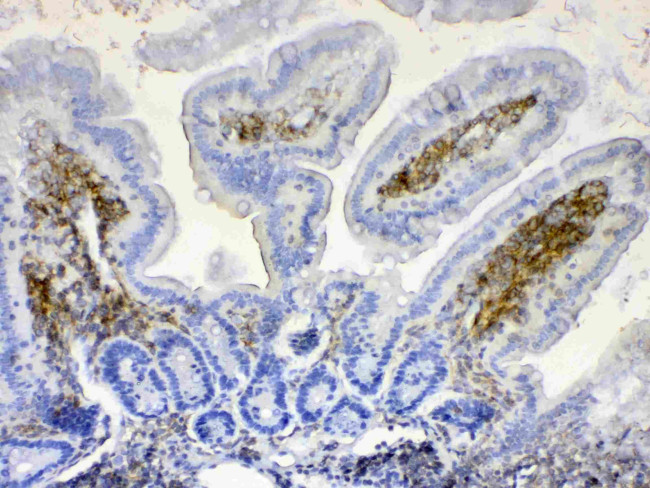 Lyn Antibody in Immunohistochemistry (Paraffin) (IHC (P))