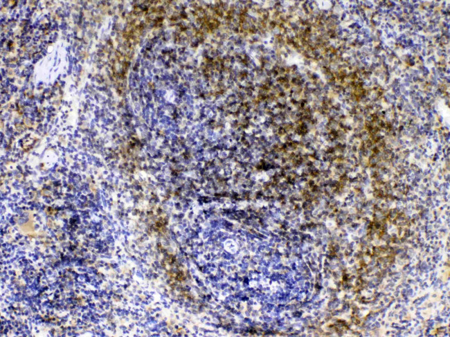 Lyn Antibody in Immunohistochemistry (Paraffin) (IHC (P))