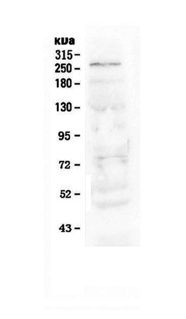 NOTCH1 Antibody in Western Blot (WB)