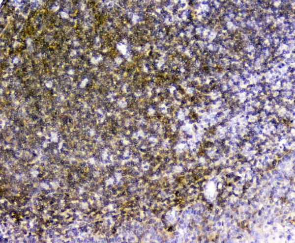 TRAIL Antibody in Immunohistochemistry (Paraffin) (IHC (P))