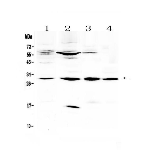 VEGFB Antibody in Western Blot (WB)