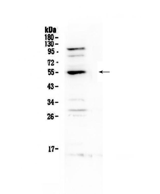 EpoR Antibody in Western Blot (WB)