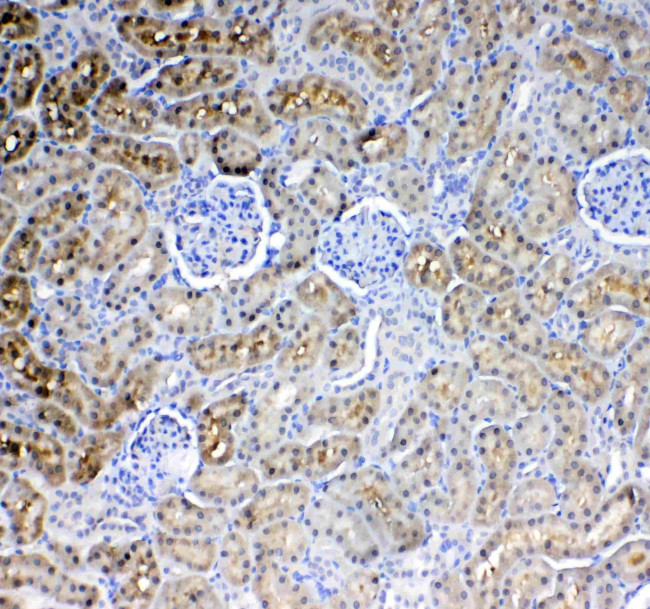 Glycerol kinase Antibody in Immunohistochemistry (Paraffin) (IHC (P))