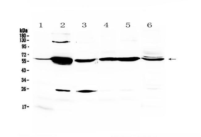 Glycerol kinase Antibody in Western Blot (WB)