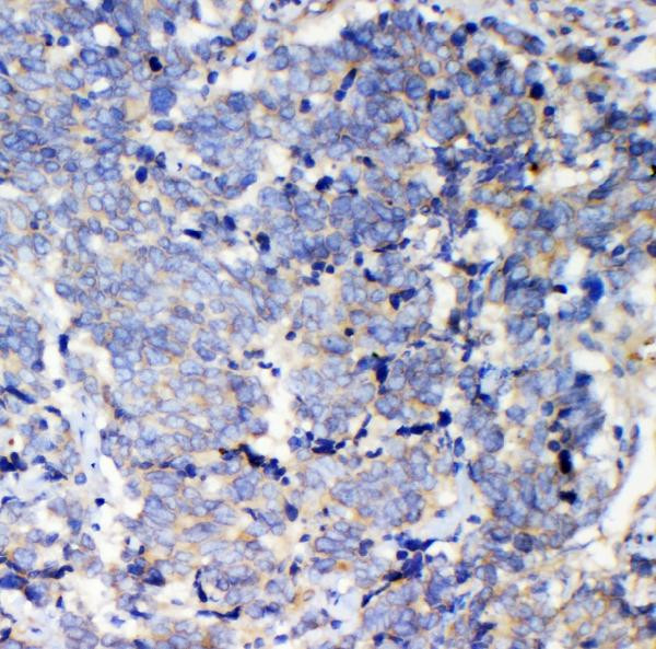 IQGAP2 Antibody in Immunohistochemistry (Paraffin) (IHC (P))