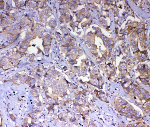 IQGAP2 Antibody in Immunohistochemistry (Paraffin) (IHC (P))