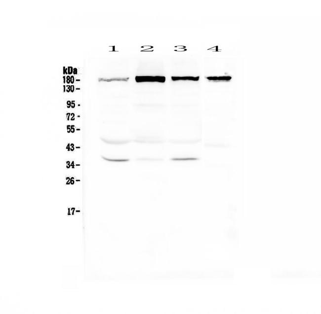 IQGAP2 Antibody in Western Blot (WB)